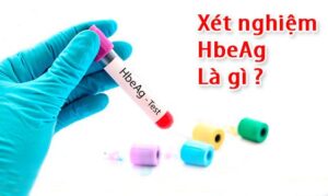 Xét nghiệm HBeAg trong chẩn đoán viêm gan B