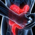 11 điều bác sĩ thực sự muốn bạn biết về bệnh Crohn