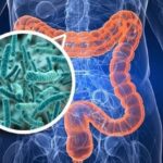 8 điều đáng ngạc nhiên gây hại cho vi khuẩn đường ruột của bạn