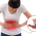 Liên quan giữa đau dạ dày và đau lưng