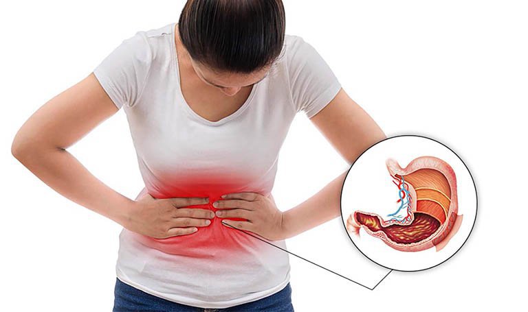 Liên quan giữa đau dạ dày và đau lưng