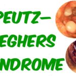 Hội chứng Peutz-Jeghers là gì và có liên quan thế nào tới ung thư đường tiêu hóa?