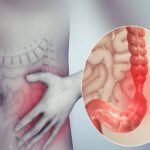 Mối liên hệ giữa bệnh Crohn và đau khớp