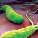 Nhiễm vi khuẩn HP trong dạ dày có cần điều trị không?