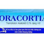 Thuốc bôi nhiệt miệng Oracortia có nuốt được không?