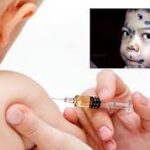 Bé lớn bị thủy đậu bé thứ 2 tiêm vắc-xin thủy đậu có tác dụng không?