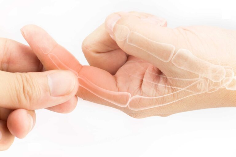 Viêm thoái hoá khớp ngón tay: Những điều cần biết