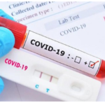 Sau nhiễm Covid bao lâu nên xét nghiệm PCR?