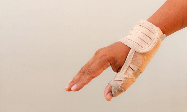 Điều trị và phục hồi viêm gân vùng mỏm trâm quay cổ tay